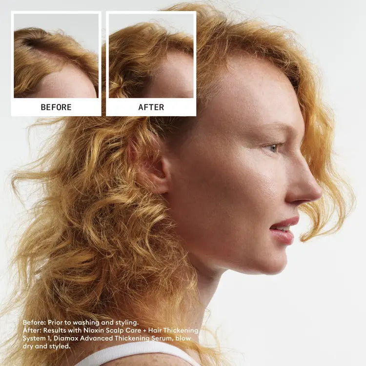 NIOXIN KIT 1