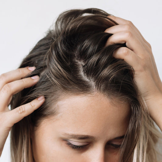 Cómo quitar la grasa del pelo sin destrozarlo en el intento.