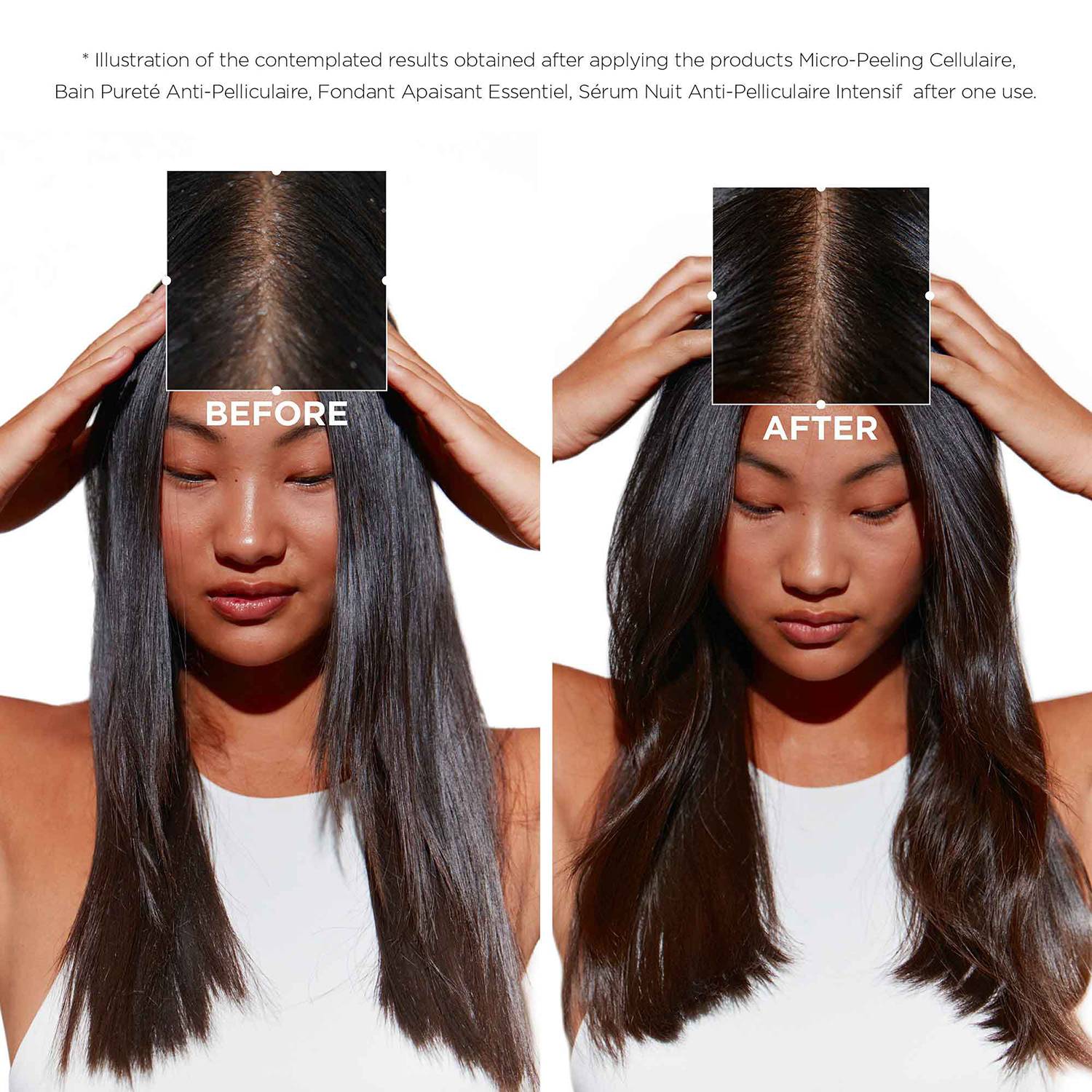 Sérum capilar Kérastase Symbiose Anti Caspa 90ml